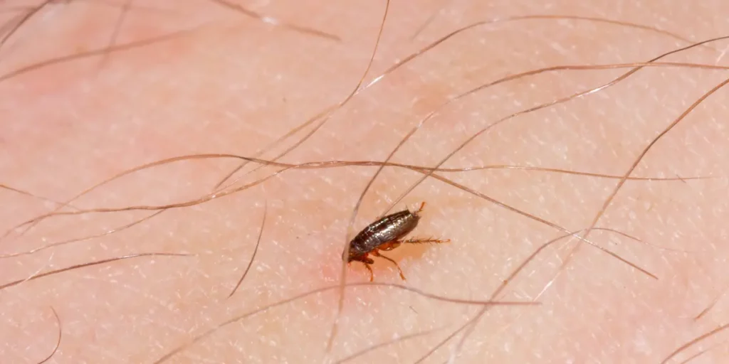 How To Treat Flea Bites